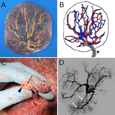 The human placenta as a model for training and research in mechanical thrombectomy: Clarifications and use of the chorionic plate veins